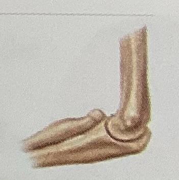 <p>The joint shown in the picture is</p>