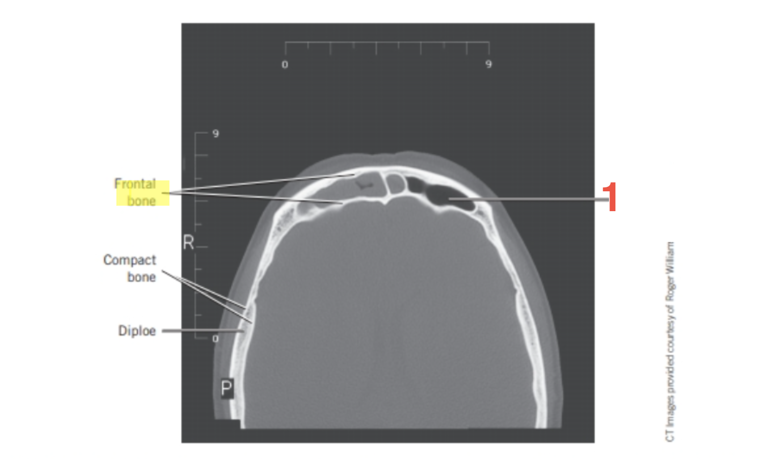 <p>1</p>
