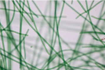 <p>This organism is a type of what photosynthetic bacteria?</p>