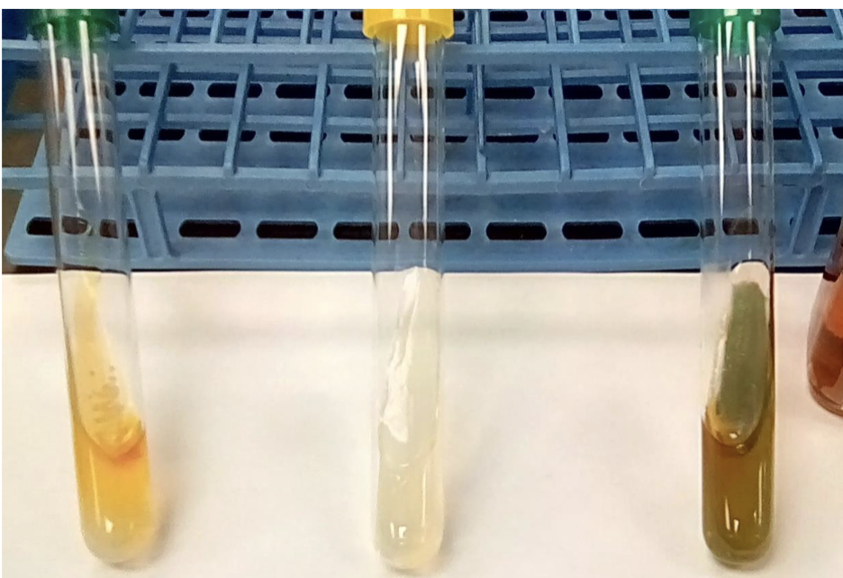 <p>what’s the enzyme?</p>