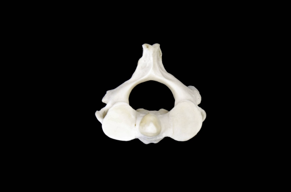 <p>Identify the vertebrae </p>