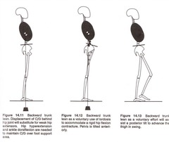 <p>Trunk inclination due to weak hip extensors.</p>