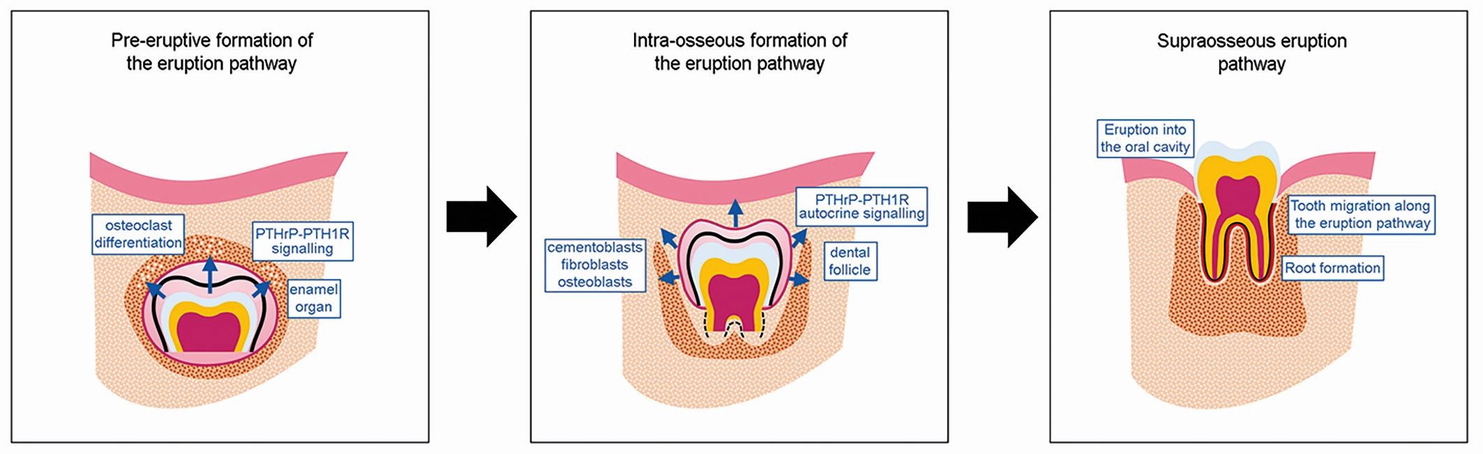 <p>prior to the complete calcification of its root </p><p>(tooth usually erupts before root is finished)</p>