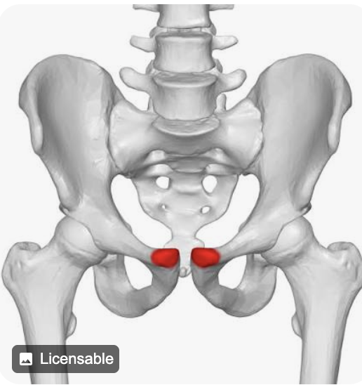 <p>Name this part of the pelvic bone</p>