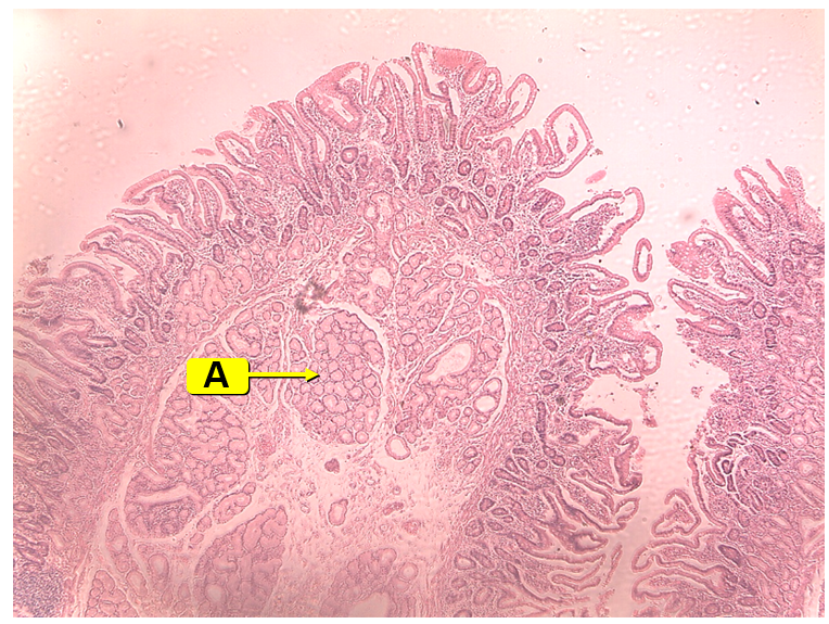 <p>Identify the image along with the labeled structure and its function</p>