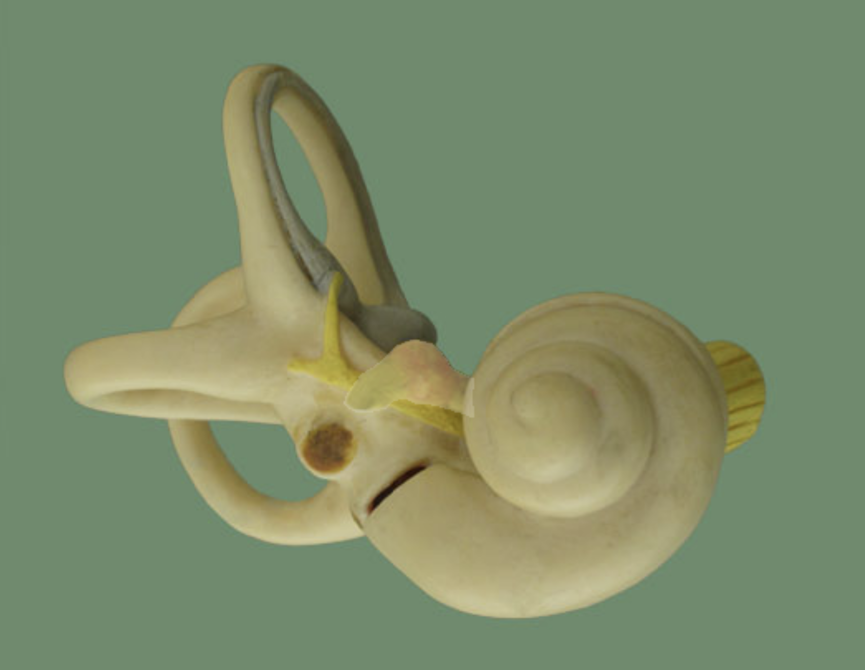term image