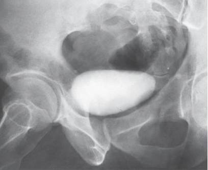 <p>What is this projection?</p>