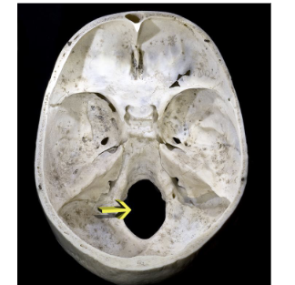 <p>What is the location of the spinal cord? Where does it extend from?</p>