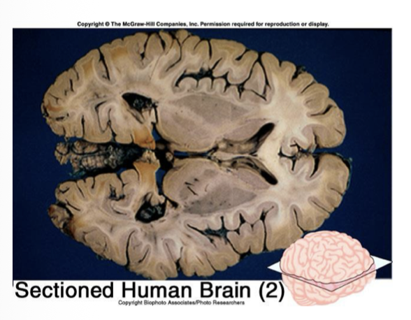<p>Divides the body into superior and inferior</p>