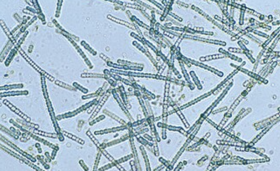 <p>chain of cyanobacteria that allows for a passage for nutrient sharing </p>