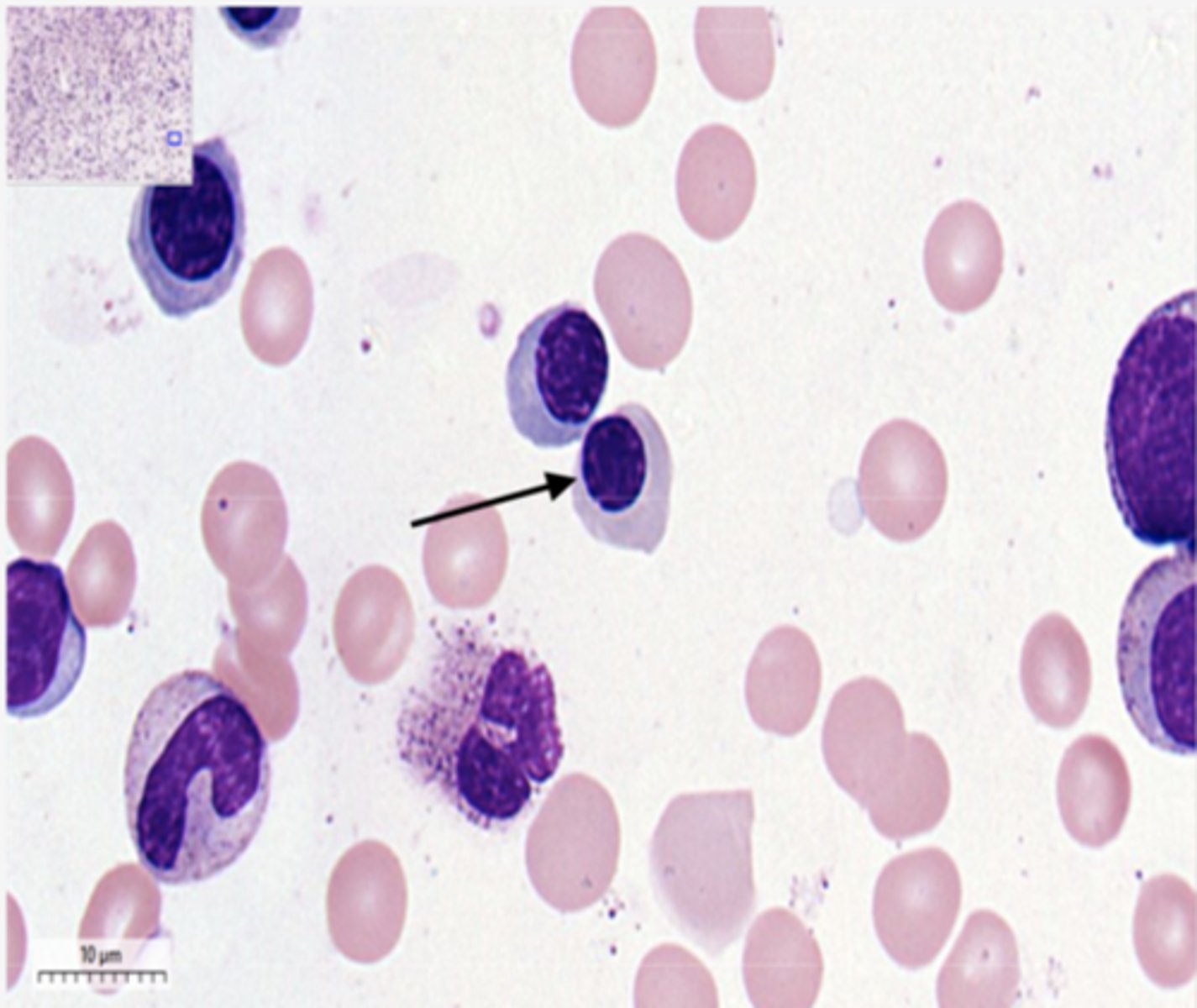 <p>Identify the DEVELOPING Cell</p>