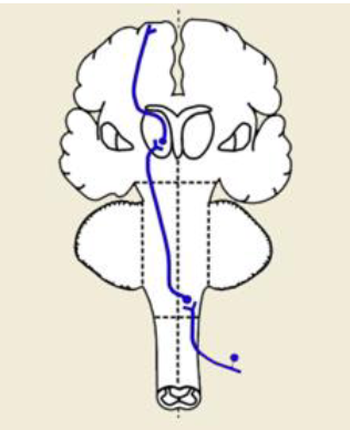 <p>Dorsal column-medial lemniscus pathway </p>