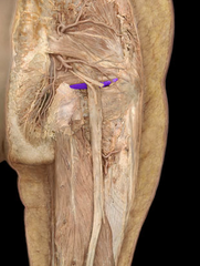<p>Nerve to Quadratus femoris</p>