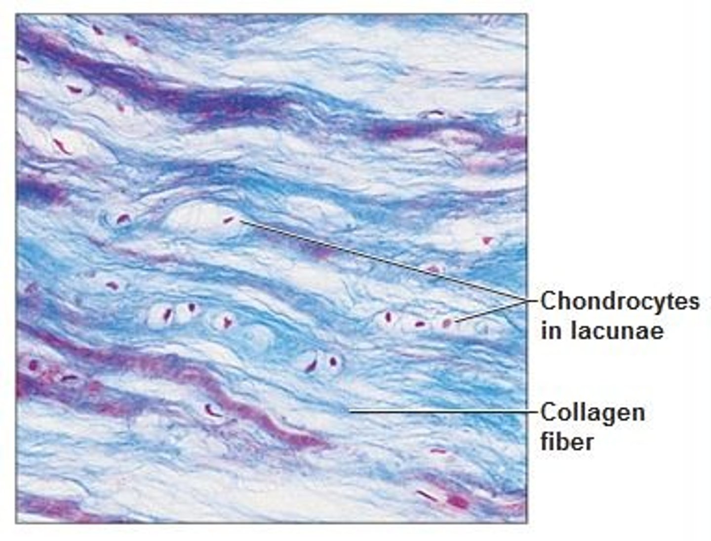 <p>comprised of DRCT and hyaline cartilage and contains fibroblasts as well as chondrocytes.</p><p>cartilage that contains fibrous bundles of t1 collagen, such as that of the intervertebral disks in the spinal cord. sternoclavicular and temporomandibular joints.</p>