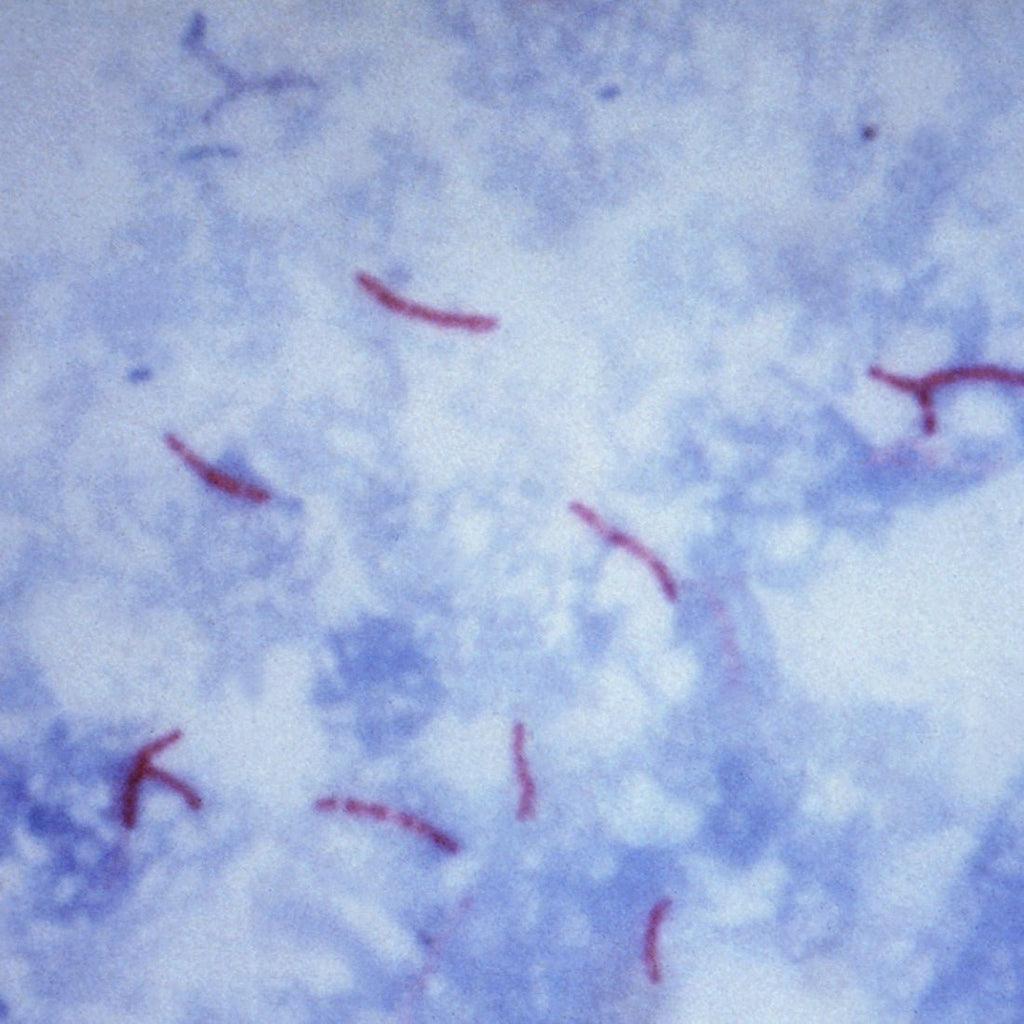 <p><em>Centers for Disease Control and Prevention, V. McPheeters. (1965). Ziehl–Neelsen-stained specimen showing Mycobacterium tuberculosis [Photomicrograph]. Public Health Image Library, Image ID 23000.</em></p>