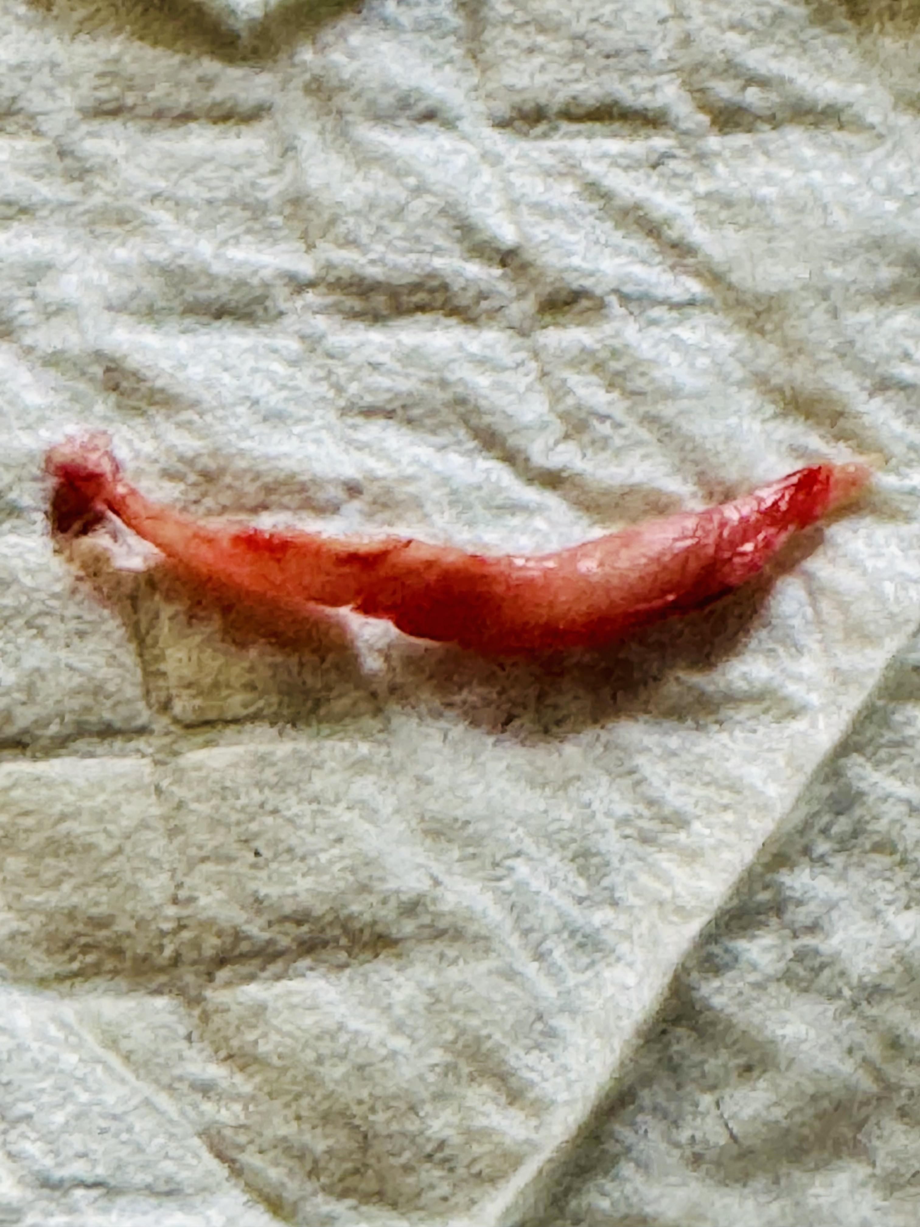 <p>Blood is stagnant and separates. RBCs stick towards the ground while plasma and platelets remain on top. AKA “chicken fat clot”</p>