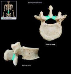<p>Posterior roof segment protecting backside of spinal cord</p>