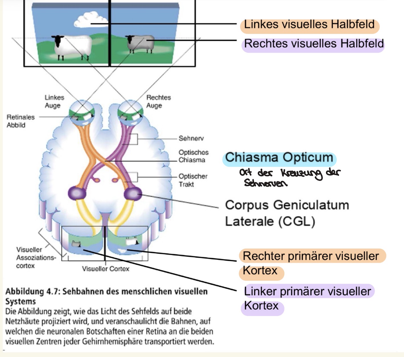 <p>Die Kreuzung der nasalen Teile der Sehnerven im <strong>Chiasma Opticum</strong> führt dazu das:</p><p>visuelle Informationen des <strong>linken visuellen Halbfelds</strong> werden im <strong>rechten primären visuellen Kortex</strong> abgebildet und umgekehrt</p><p>visuelle Information des <strong>rechten visuellen Halbfelds im linken primären visuellen Kortex</strong></p><p></p><p><span>Im <strong>Corpus Geniculatum Laterale (CGL) </strong>werden Informationen aus der Netzhaut verarbeitet und an den Kortex weitergeleitet</span></p><p><span>Dort lassen sich magno- & parvozelluläre Zellen unterscheiden</span></p>