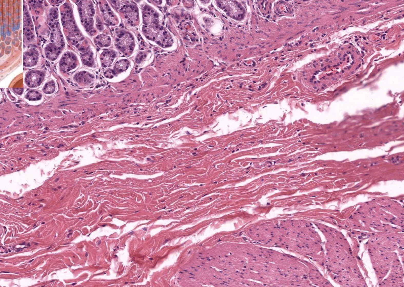 <p>Identify the Layers and Where?</p>