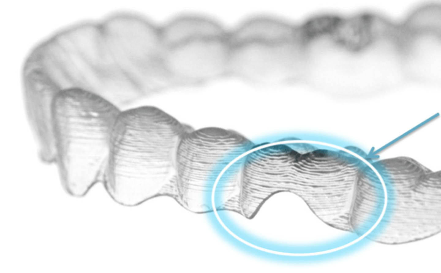 <p>ID feature of aligner:</p>