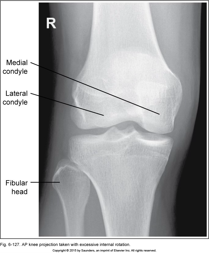 <p>AP knee</p>
