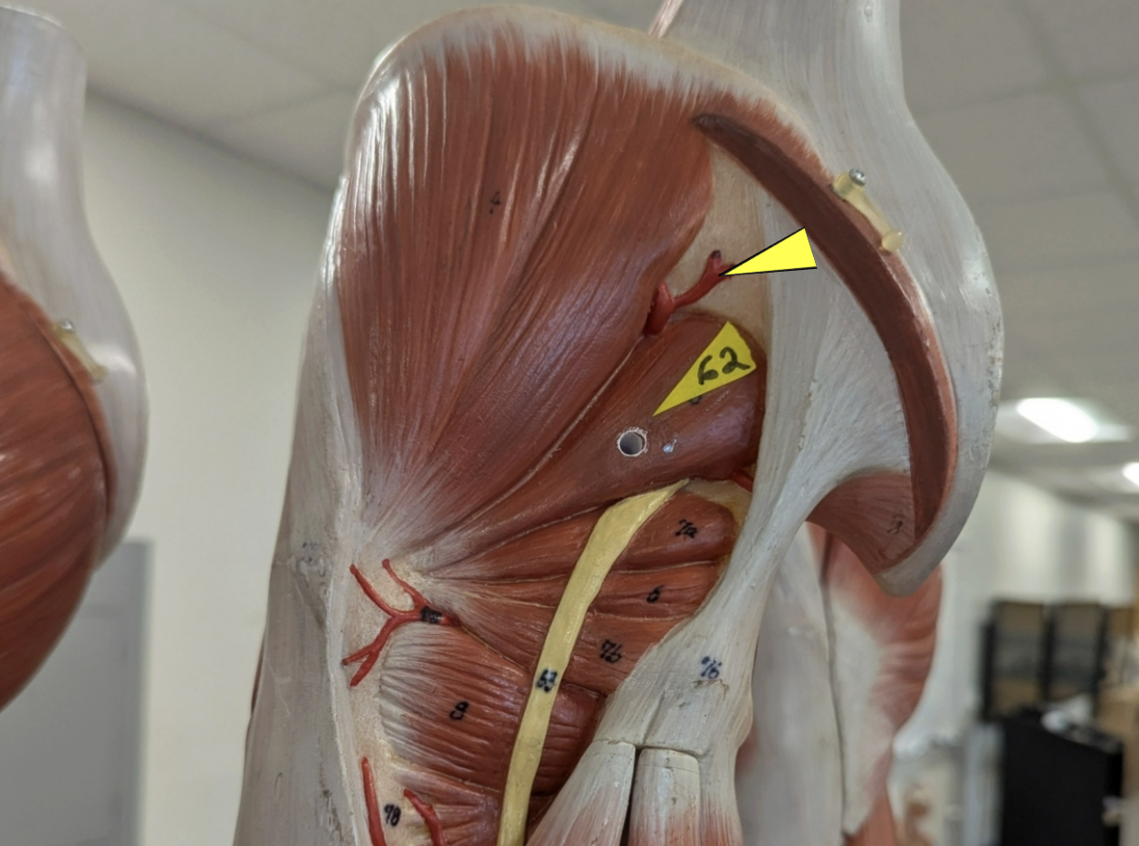 <p>what artery is this</p><p>what muscles does it supply (3)</p>