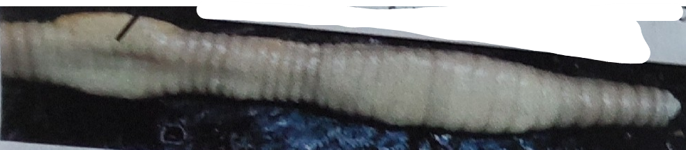 <p>What side is of the earthworm is this </p>