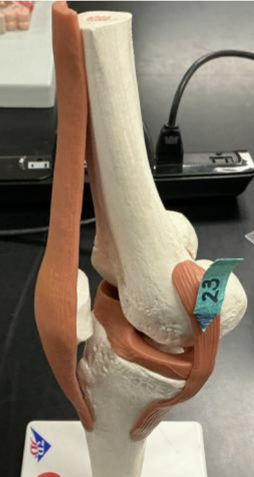 <p>______________ is the predominant connective tissue in the structure labeled 23.</p>