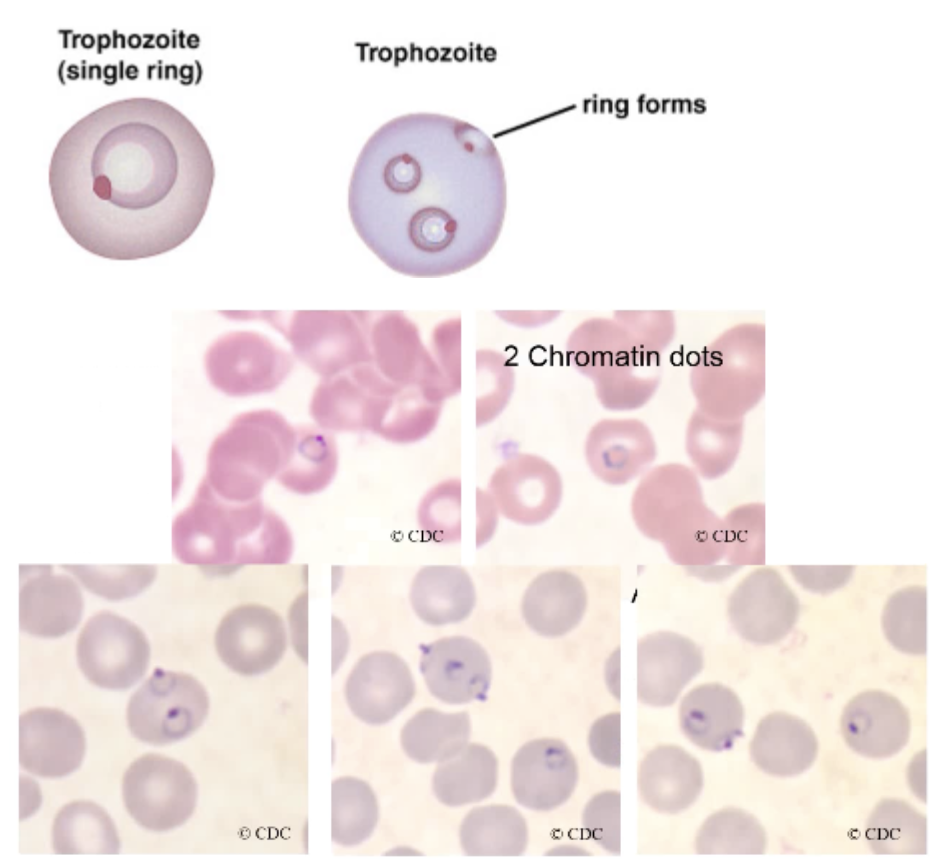 <ul><li><p><span style="background-color: transparent;">Plasmodium falciparum, or falciparum, can infect red blood cells of all ages, so the parasitic load of this parasite tends to be the highest.</span></p></li><li><p><span style="background-color: transparent;">The typical small, delicate ring form of Plasmodium falciparum consists of scanty cytoplasm connected to one or two small chromatin dots.</span></p></li><li><p><span style="background-color: transparent;">A small vacuole is also always visible.</span></p></li><li><p><span style="background-color: transparent;">Multiple rings in the red blood cells are frequently seen, and you can see applique forms where the ring form lines up against the edge of the red blood cells.</span></p></li><li><p><span style="background-color: transparent;">multiple rings = key characteristic</span></p></li></ul><p></p>