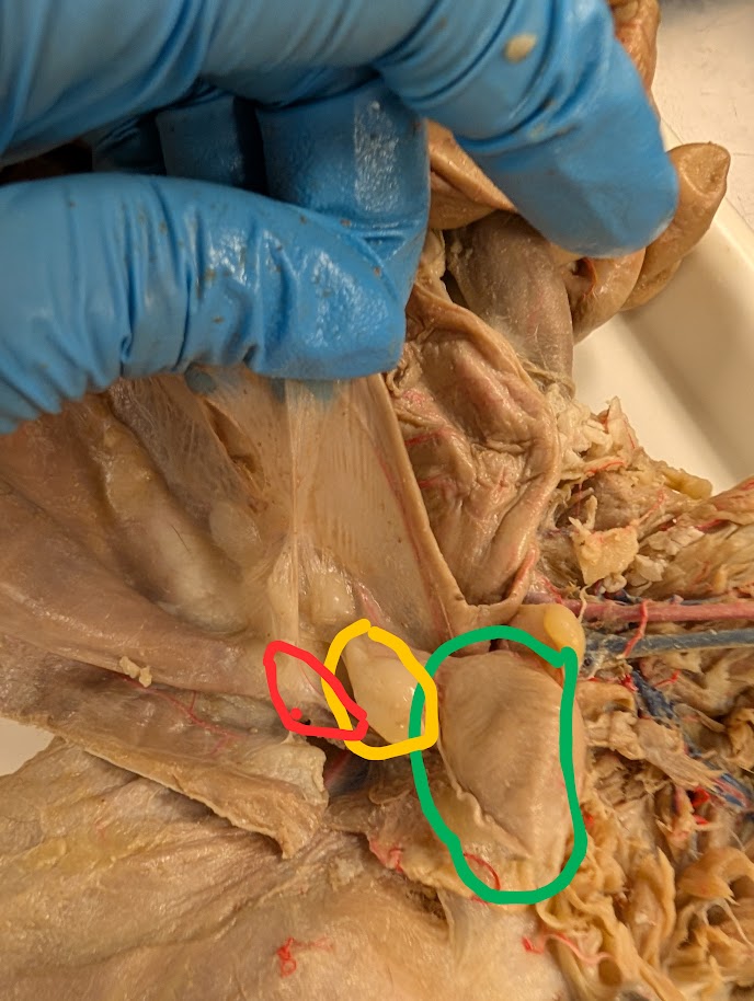 <p>What is circled in red</p>