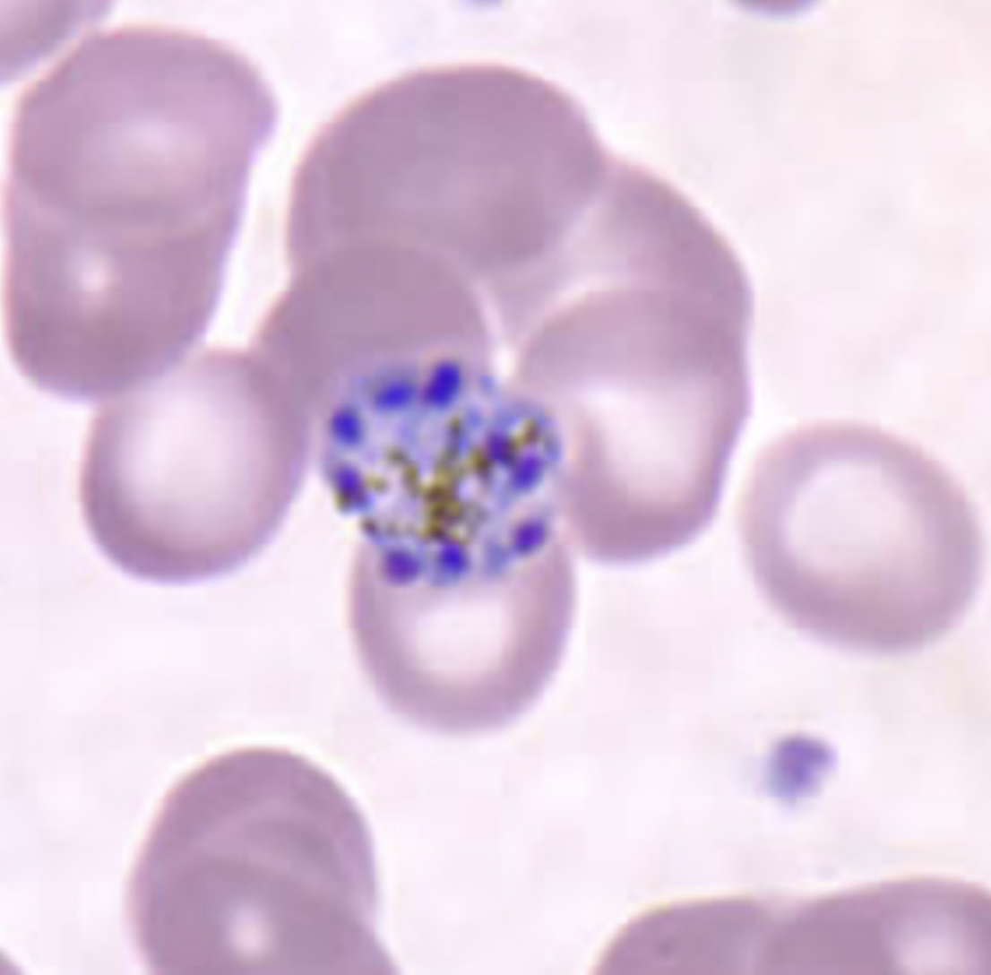 <p>What parasite is this?</p>