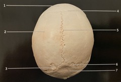 <p>What structure is #2? (Fig. 3.5 Skull, Superior View)</p>