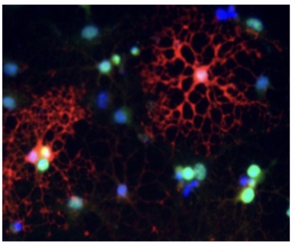 <p>Oligodendrocyte: Function: <span>Form myelin sheath in the CNS. Insulation of axons </span></p>