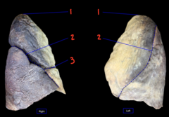 <p>What is labeled 2?</p>