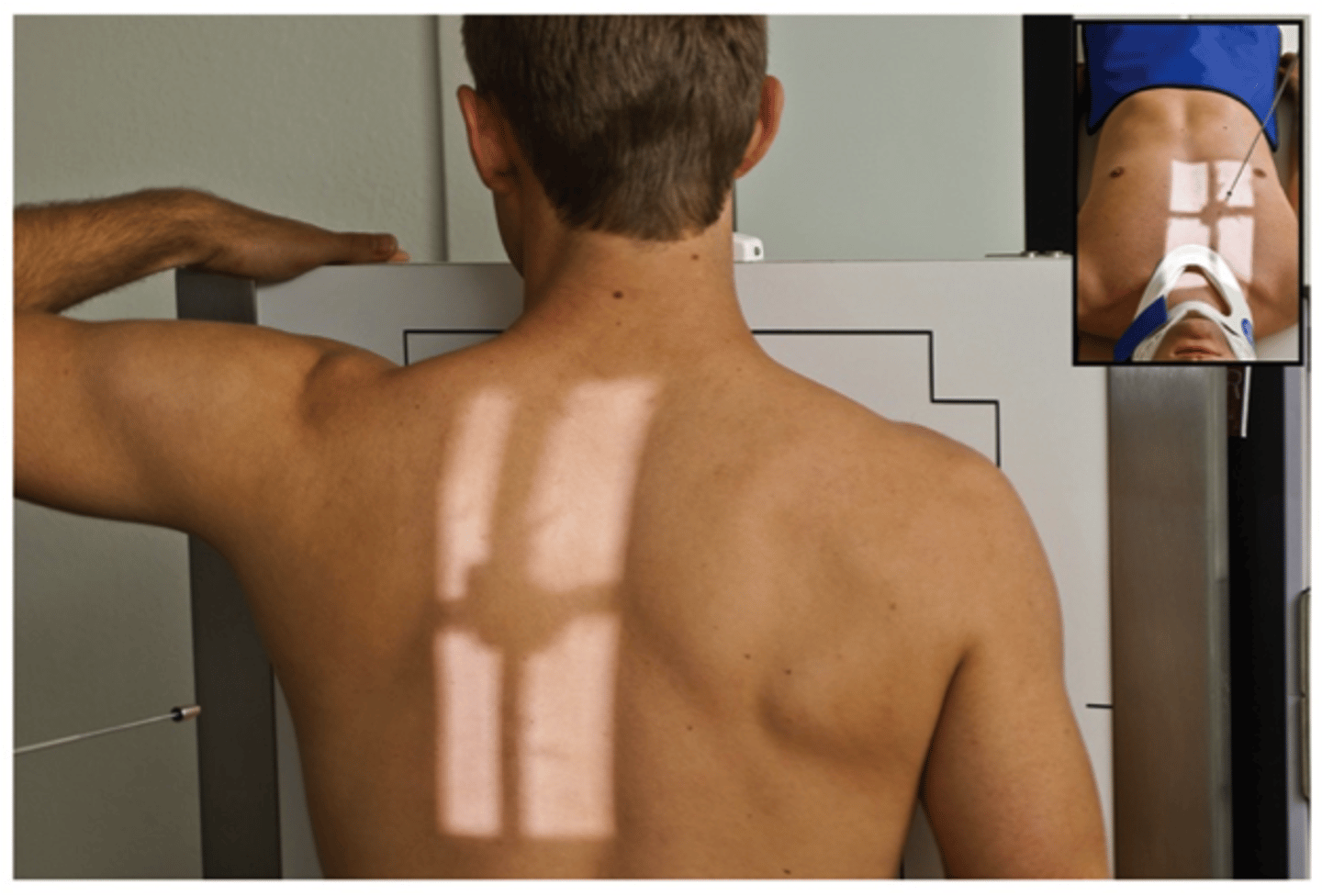 <p>- What exam is this?</p><p>- What is the SID?</p><p>- Is the patient shielded?</p><p>- How is the patient positioned?</p><p>- How many degrees is the body obliqued?</p><p>- Where is the CR?</p><p>- What are the breathing instructions?</p><p>- What anatomy is demonstrated?</p>