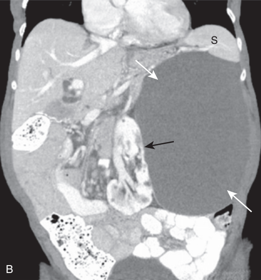 <p>diagnosis</p>