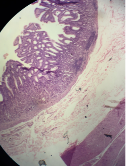 <p>-What is pictured? What two cells are involved?</p>