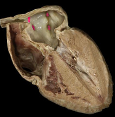 <p>identify the structure</p>