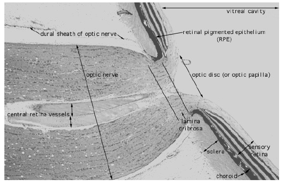 <p>posterior scleral foramen</p><p>lamina cribrosa</p>