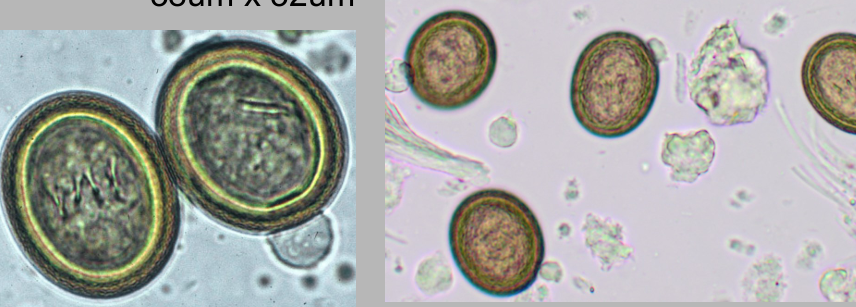 <p>Thick-shell - see tiny hooks on oncosphere</p>