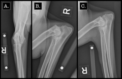 <p>What is the radiographic view of A?</p>
