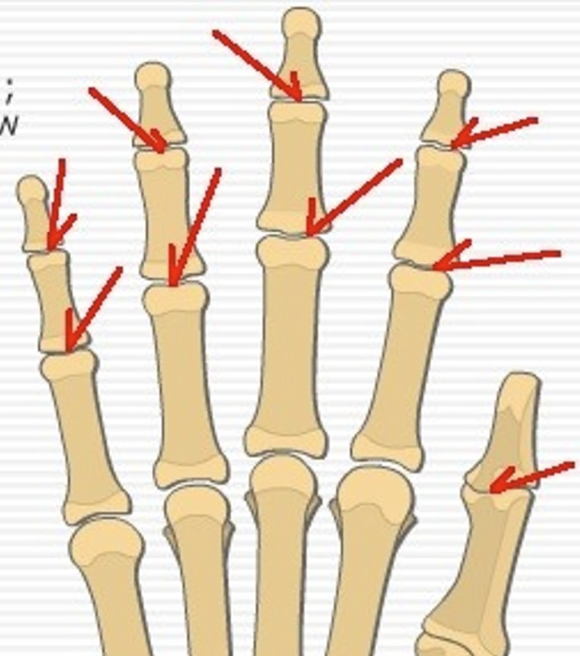 <p>What is this joint?</p>