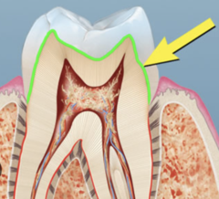 <p>What junction is highlighted</p>