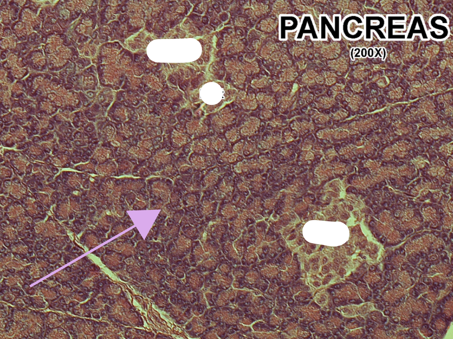 <p>What are the cells in the background?</p>