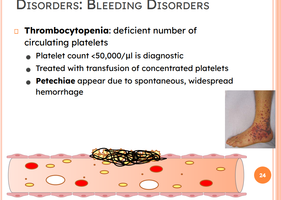 <p>Thrombocytopenia: deficient number of circulating platelets</p><ul><li><p>Platelet count <50,000/μl is diagnostic</p></li><li><p>Treated with transfusion of concentrated platelets</p></li><li><p>Petechiae appear due to spontaneous, widespread</p></li></ul><p>hemorrhage</p>