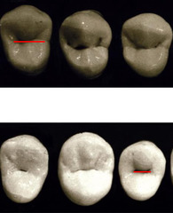 <p>Is the central groove longer on maxillary first or second premolars?</p>