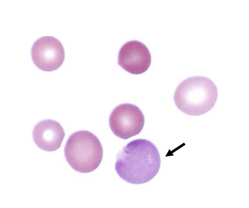 <p>What is this RBC, and what are the 2 main characteristics</p><p></p>