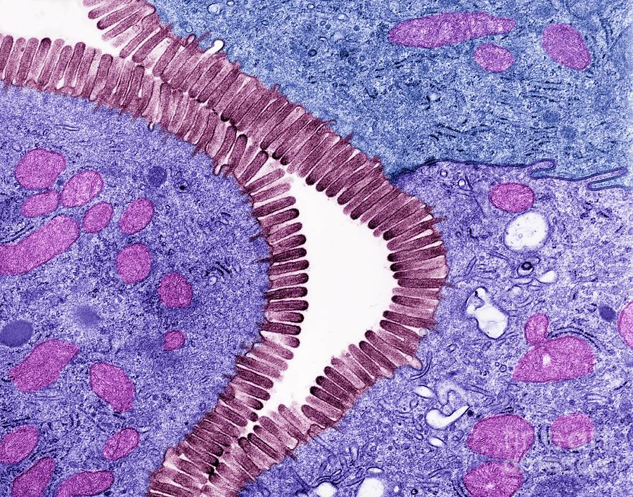 <p>special structure found in small intestine; increase surface area</p>