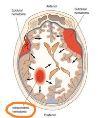 <p>change over time and may not be immediately evident on the initial scan</p>