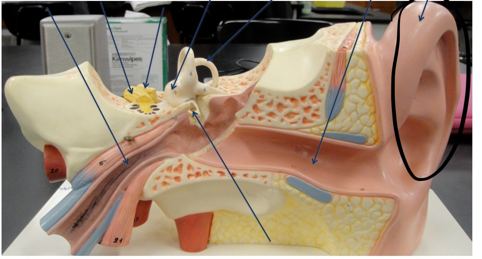 <p>Identify the circled area?</p>